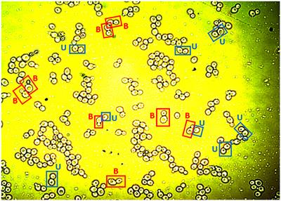 Digital Image Analysis of Yeast Single Cells Growing in Two Different Oxygen Concentrations to Analyze the Population Growth and to Assist Individual-Based Modeling